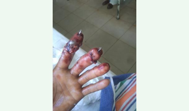 Cover I need fix my hand.please help me