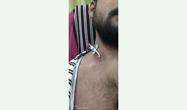 Cover kidney disease 