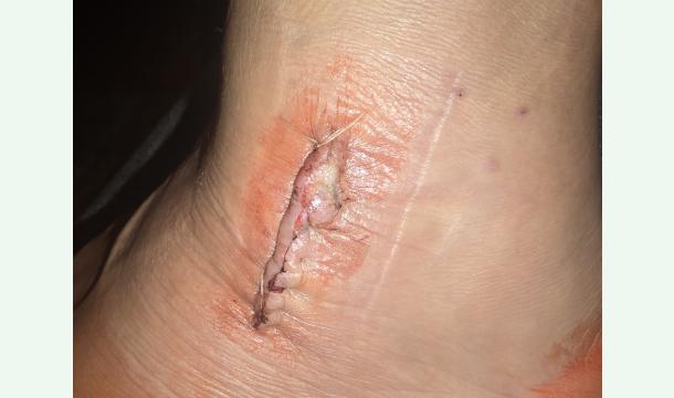 Cover Ürfall und krankeit