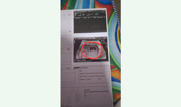 Cover Born new Baby.