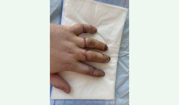 Cover Un accident … et un nouveau départ à financer