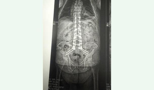 Cover Deux fauteuils roulants, un même rêve : retrouver la liberté d’être ensemble en mouvement     💛...