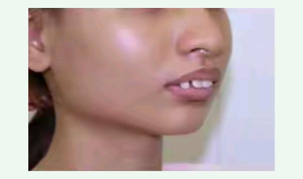 Cover Help Me Restore My Smile