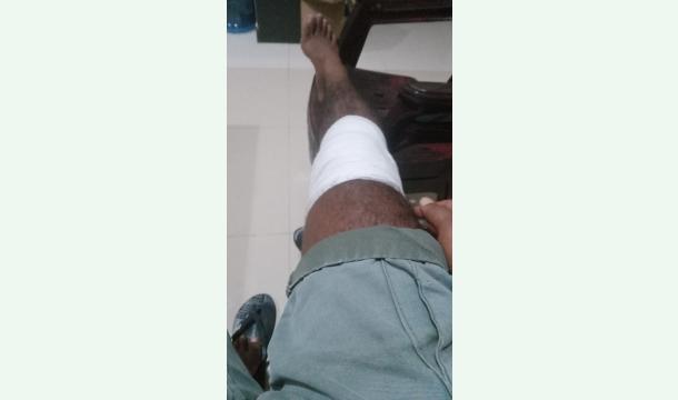 Cover Heal the unwell condition of the legs