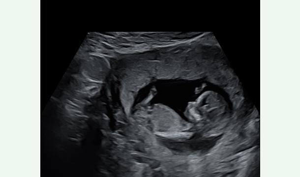 Cover Liste de Naissance Thomas 