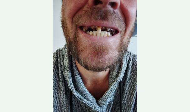 Cover Meine Zähne flicken