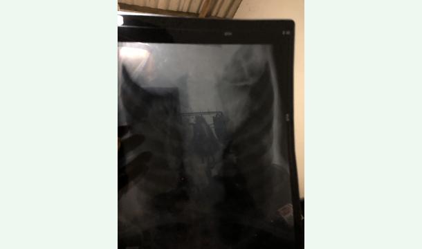 Cover My name is ayodya  . My grandfather issuffering from cancer 