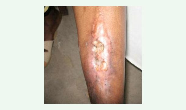 Cover ❤️ Help Rohan Gunarathne Recover, Continue Teaching & Rebuild His Life ❤️