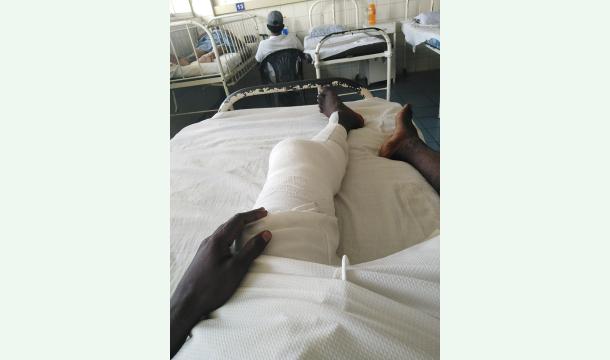 Cover Need to operation 