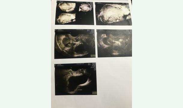 Cover A Heartfelt Appeal to Help Us Fulfill Our Dream of Becoming Parents