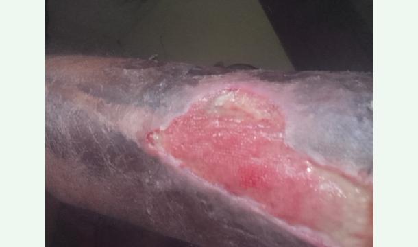 Cover Iam leg oparesion