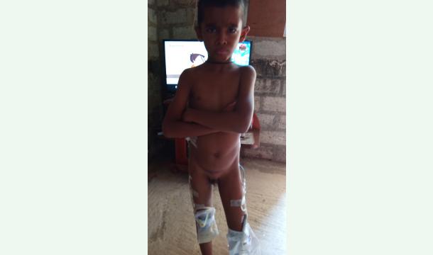 Cover Treatment to my son kidney disease 