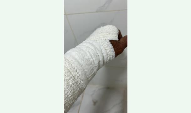 Cover I am tired too much. Please help me.