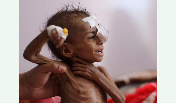 Cover Lutte contre la famine au Yémen - Bekämpfung der Hungersnot im Jemen - Fighting Famine in Yemen