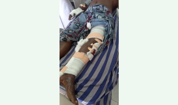 Cover To make the bones of the arms and legs.Help me save my life.