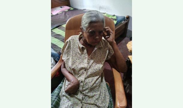 Cover For treatment for my mother