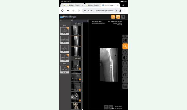 Cover Total Hip Replacement surgery 