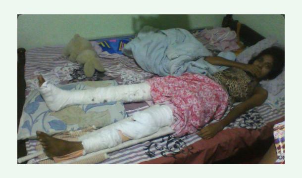 Cover I Need Your Help to Walk Again 