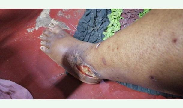 Cover I am very sick. 