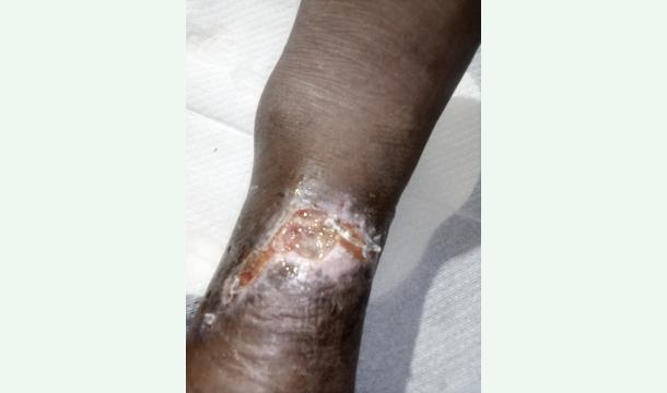 Cover Don't leave me alone.Heal the painful wound