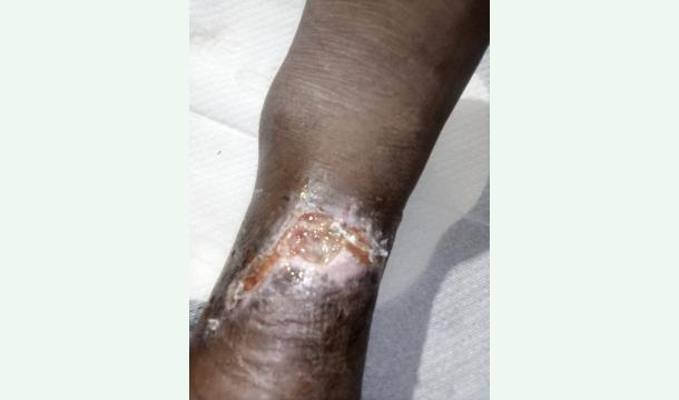 Cover dont leave me alone.Heal the painful wound