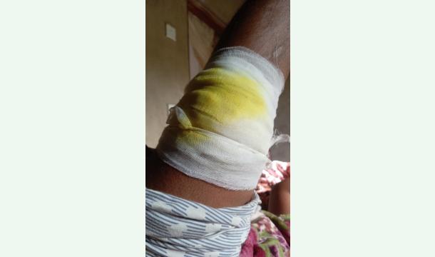 Cover I need money for my operation 