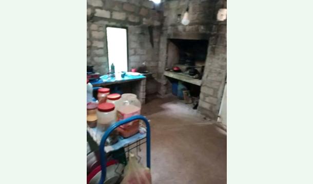 Cover Lifeless Right Hand Due To a Neurological Disease