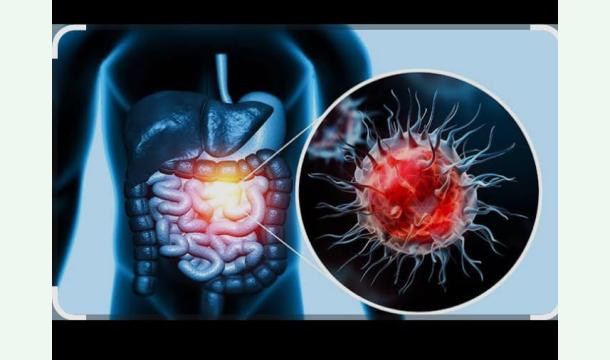 Cover Help me with my cancer