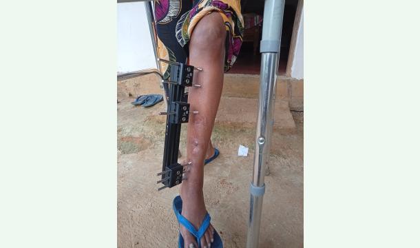 Cover Support for My Child Education