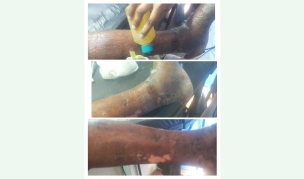 Cover Support My Mother’s Medical Treatment