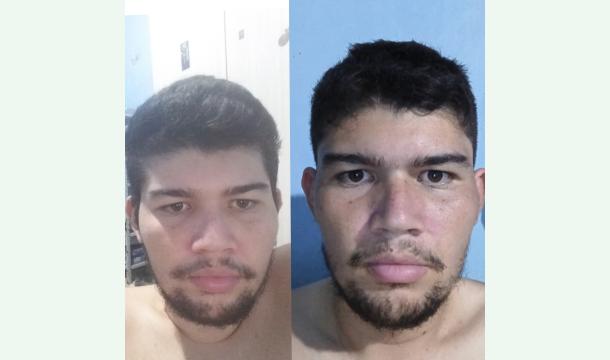 Cover Justiz und Gesundheit: Opfer eines schweren Fehlers in Teresina