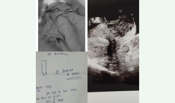 Cover Medical Support – Help Me Recover & Repay Surgery Debt