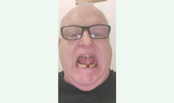 Cover refaire mes dents 